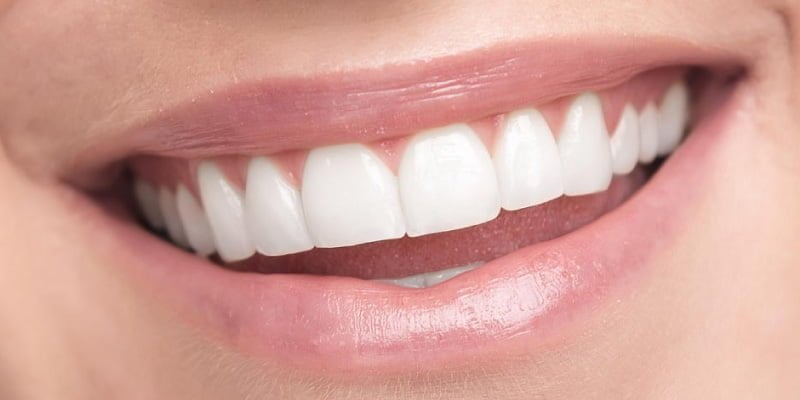 branqueamento dentário